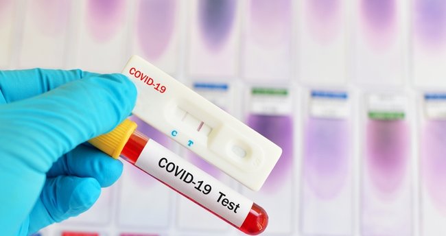 PCR testi nedir?