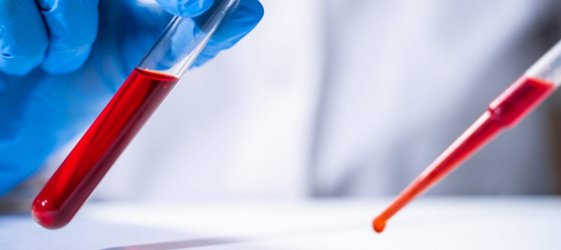 Test tubes with blood in laboratory on white background.
